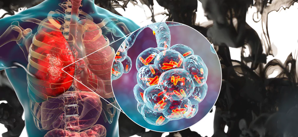 Tuberculosis and Cigarette Smoking