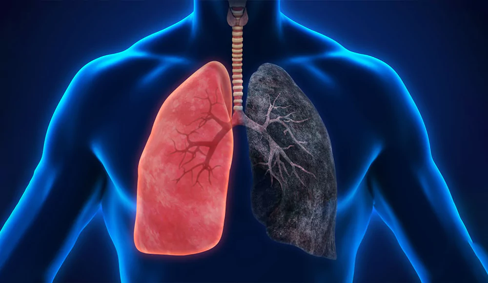 5 Effective Tips for How to Cleanse Your Lungs After Quitting Smoking